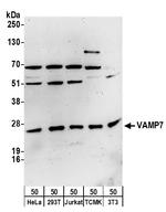 VAMP7 Polyclonal Antibody