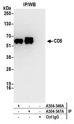 CD5 Antibody in Immunoprecipitation (IP)