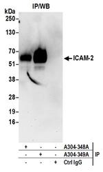 ICAM-2 Antibody in Immunoprecipitation (IP)