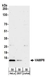 VAMP8 Polyclonal Antibody