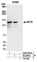 MCT8 Antibody in Immunoprecipitation (IP)