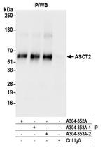 ASCT2 Antibody in Immunoprecipitation (IP)