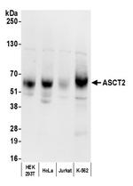 ASCT2 Polyclonal Antibody