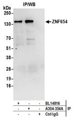 ZNF654 Antibody in Immunoprecipitation (IP)