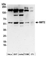 NMT2 Polyclonal Antibody