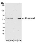 CKI-gamma1 Polyclonal Antibody
