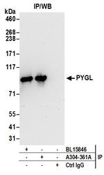 PYGL Antibody in Immunoprecipitation (IP)