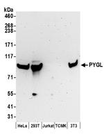 PYGL Polyclonal Antibody