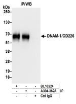 DNAM-1/CD226 Antibody in Immunoprecipitation (IP)