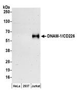 DNAM-1/CD226 Antibody in Western Blot (WB)