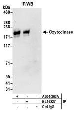 Oxytocinase Antibody in Immunoprecipitation (IP)