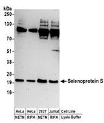 Selenoprotein S Polyclonal Antibody