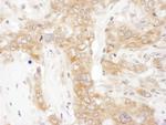 VAP-33 Polyclonal Antibody
