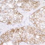 B7-H3/CD276 Antibody in Immunohistochemistry (Paraffin) (IHC (P))