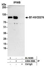 B7-H3/CD276 Antibody in Immunoprecipitation (IP)