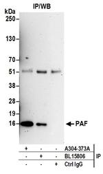 PAF Antibody in Immunoprecipitation (IP)