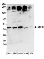 DHPS Polyclonal Antibody