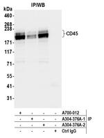 CD45 Antibody in Immunoprecipitation (IP)