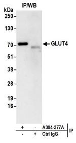 GLUT4 Polyclonal Antibody