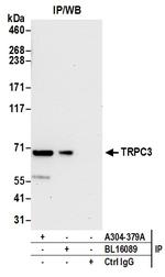 TRPC3 Antibody in Immunoprecipitation (IP)