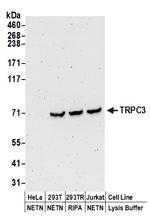 TRPC3 Polyclonal Antibody