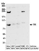 TfR Antibody in Western Blot (WB)