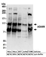 ADAM9 Polyclonal Antibody