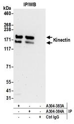 Kinectin Antibody in Immunoprecipitation (IP)