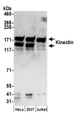 Kinectin Polyclonal Antibody