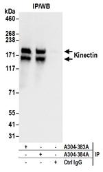 Kinectin Antibody in Immunoprecipitation (IP)