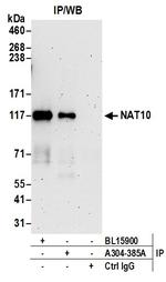 NAT10 Antibody in Immunoprecipitation (IP)