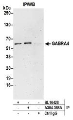 GABRA4 Polyclonal Antibody