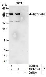 Myoferlin Antibody in Immunoprecipitation (IP)