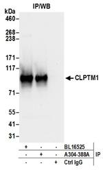 CLPTM1 Antibody in Immunoprecipitation (IP)
