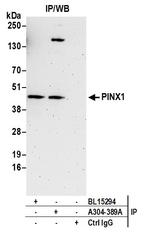 PINX1 Antibody in Immunoprecipitation (IP)