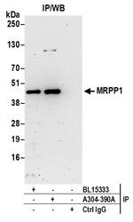 MRPP1 Polyclonal Antibody