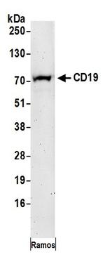 CD19 Antibody in Western Blot (WB)