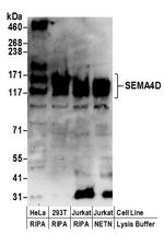 SEMA4D Polyclonal Antibody