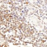 CD7 Antibody in Immunohistochemistry (Paraffin) (IHC (P))