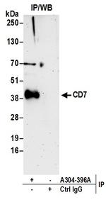 CD7 Antibody in Immunoprecipitation (IP)