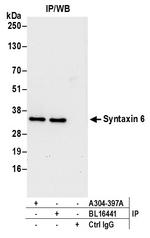 Syntaxin 6 Antibody in Immunoprecipitation (IP)