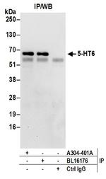 5-HT6 Antibody in Immunoprecipitation (IP)