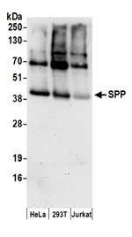 SPP Polyclonal Antibody