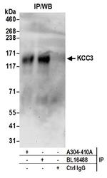 KCC3 Polyclonal Antibody