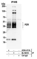 PZR Antibody in Immunoprecipitation (IP)