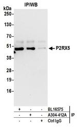 P2RX5 Antibody in Immunoprecipitation (IP)