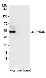P2RX5 Antibody in Western Blot (WB)