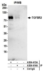 TGFBR2 Polyclonal Antibody