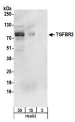 TGFBR2 Polyclonal Antibody