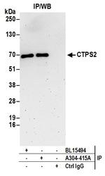 CTPS2 Antibody in Immunoprecipitation (IP)